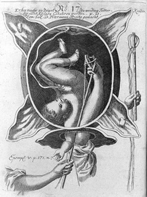 Aus einem Hebammenlehrbuch um 1760. Foto: zVg